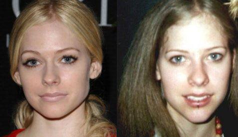 欧美明星 鼻子,欧美明星鼻子的独特魅力与审美标准